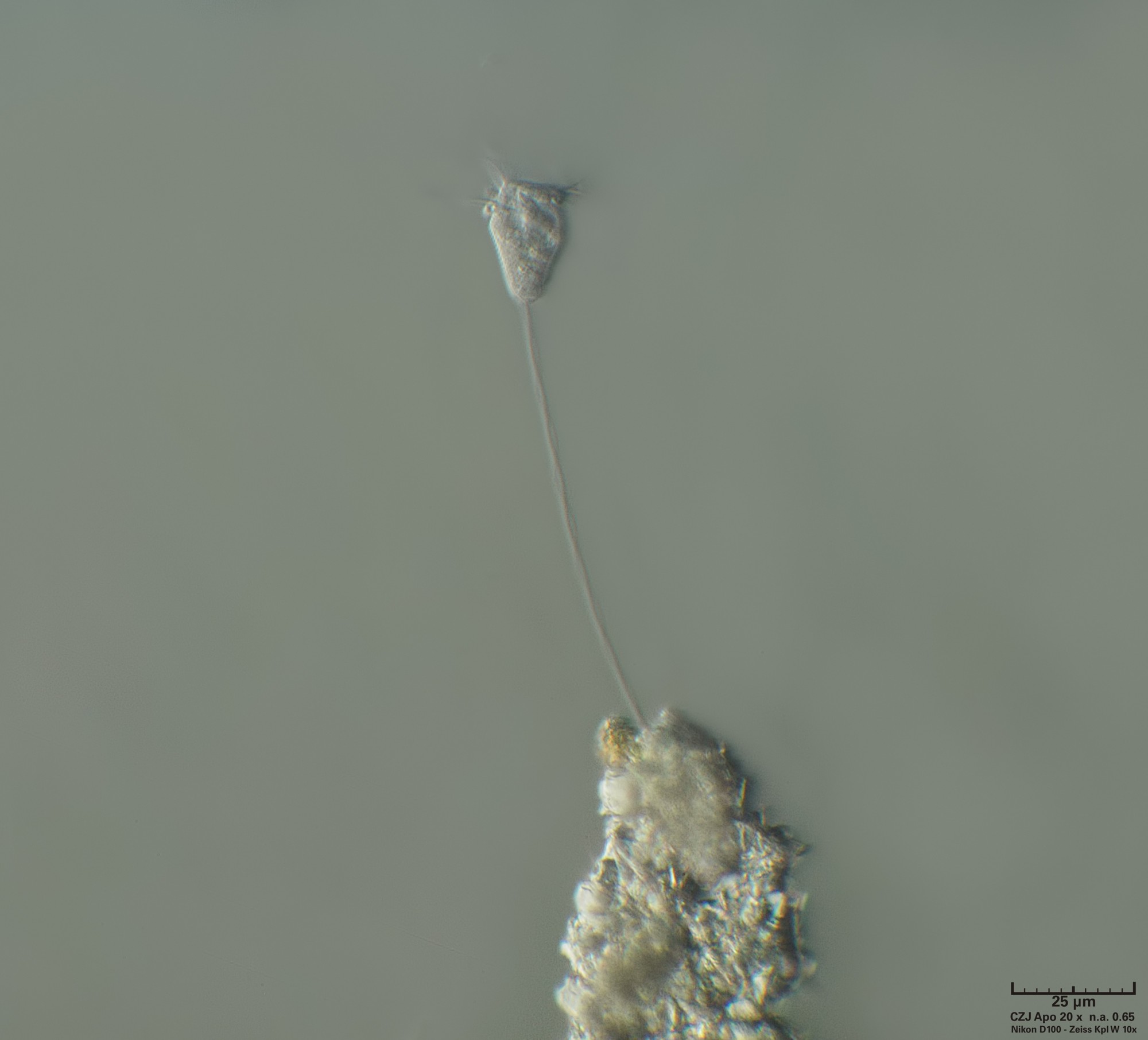 Vorticella